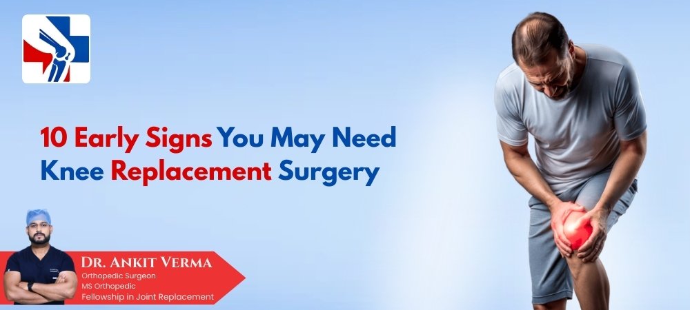 10 Early Signs You May Need Knee Replacement Surgery in Indore