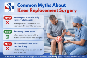 Common myths about knee replacement surgery explained with facts about recovery time and implant durability