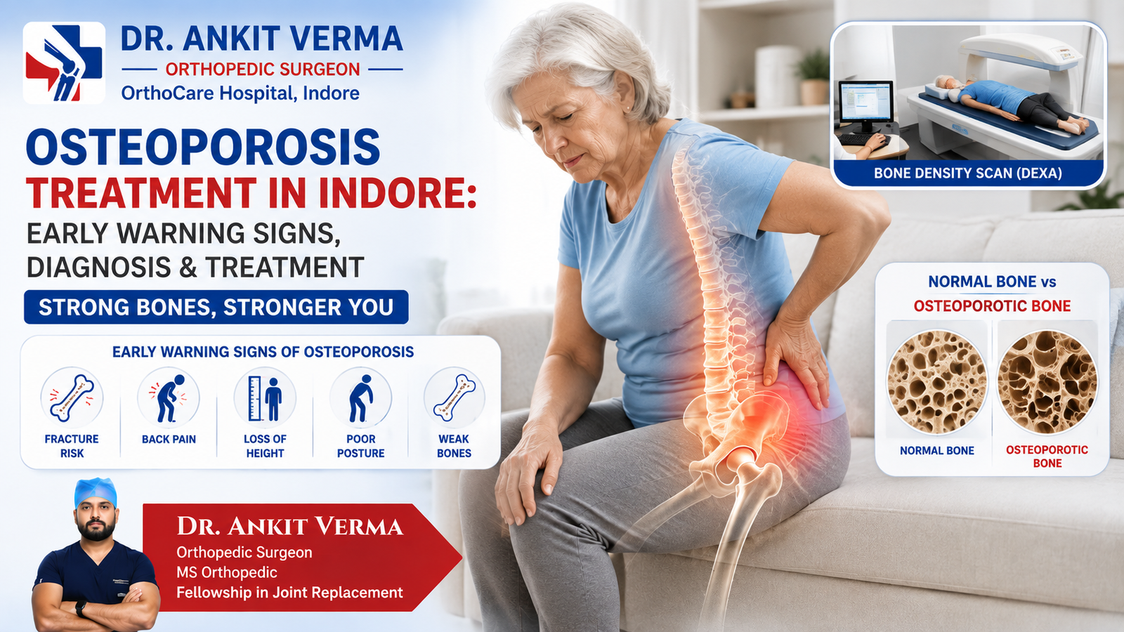 Osteoporosis Treatment in Indore: Early Warning Signs, Diagnosis & Treatment