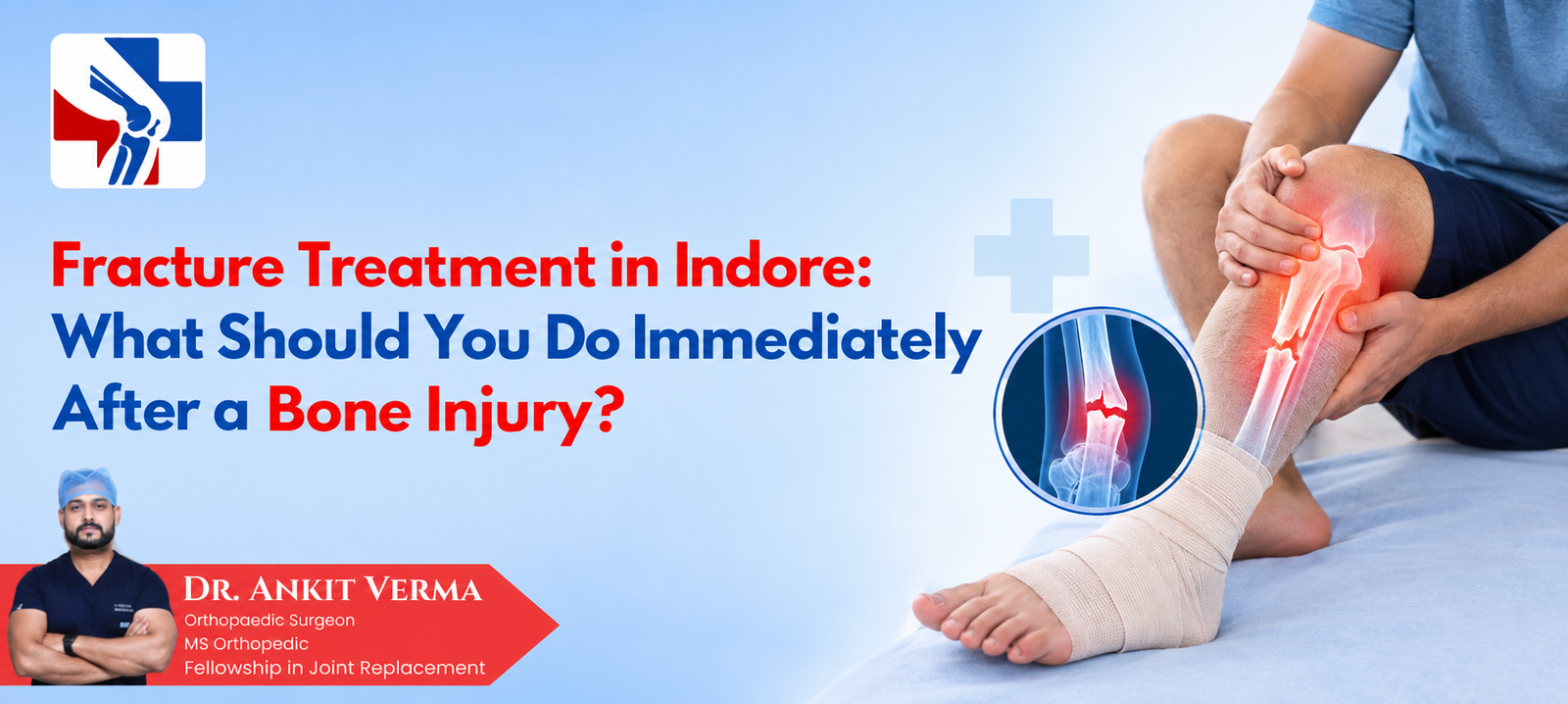 Fracture Treatment in Indore: What Should You Do Immediately After a Bone Injury? – Dr Ankit Verma